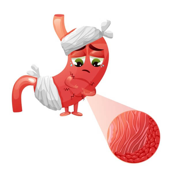 Carcinoembrionário (CEA): O marcador tumoral e o câncer de intestino